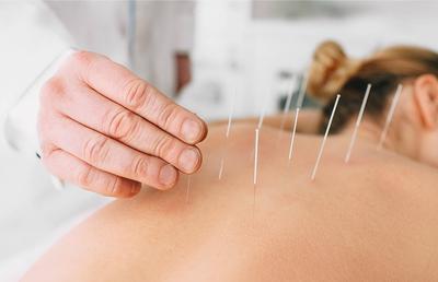 Problemele menstruale își pot găsi tratamentul și prin acupunctură