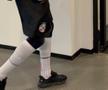Accidentat în prima repriză, Arnold Garita a plecat șchiopătând după FCSB - Rapid