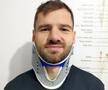 Mykola Kovtalyuk a fost accidentat de Kennedy Boateng și va lipsi cel puțin o lună și jumătate / Sursă foto: FC Botoșani