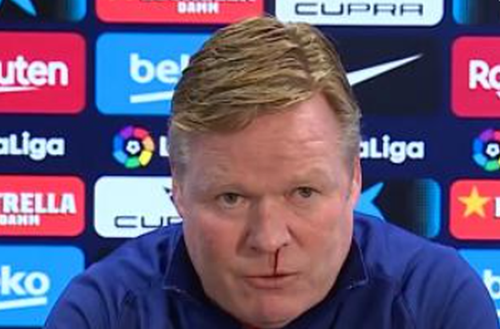 Ronald Koeman, 57 de ani, antrenorul celor de la Barcelona, a sângerat în timpul conferinței de presă premergătoare duelului cu Sevilla de sâmbătă.
