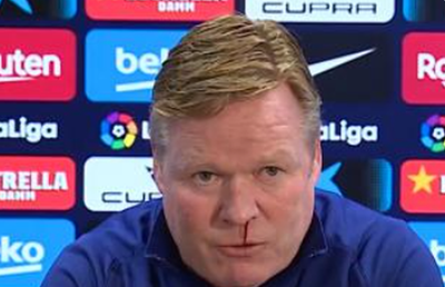 Șocant! Koeman a început să sângereze în timpul conferinței » Primele explicații
