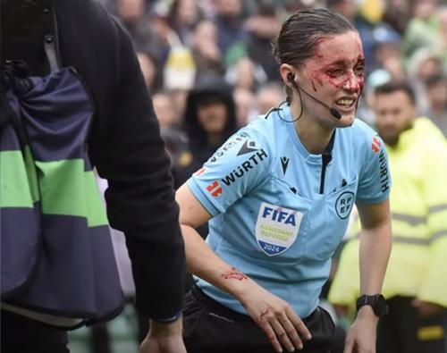 Guadalupe Porras, arbitru asistent, plină de sânge în timpul partidei din La Liga, dintre Betis - Bilbao 3-1