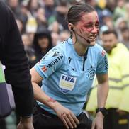 Guadalupe Porras, arbitru asistent, plină de sânge în timpul partidei din La Liga, dintre Betis - Bilbao 3-1