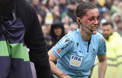 Imagine brutală cu arbitra-asistent din La Liga » Umplută de sânge după o lovitură puternică