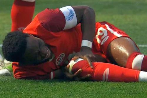 Alphonso Davies s-a accidentat la naționala Canadei și nu va mai juca în acest sezon, foto: X