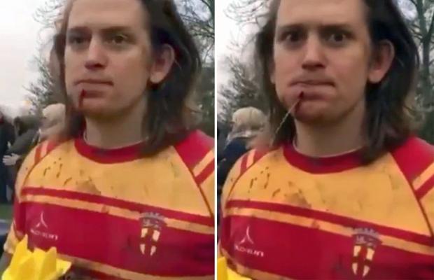 VIDEO + FOTO Accidentare cruntă » Apa a țâșnit prin gaura provocată de un crampon! Imagini interzise minorilor