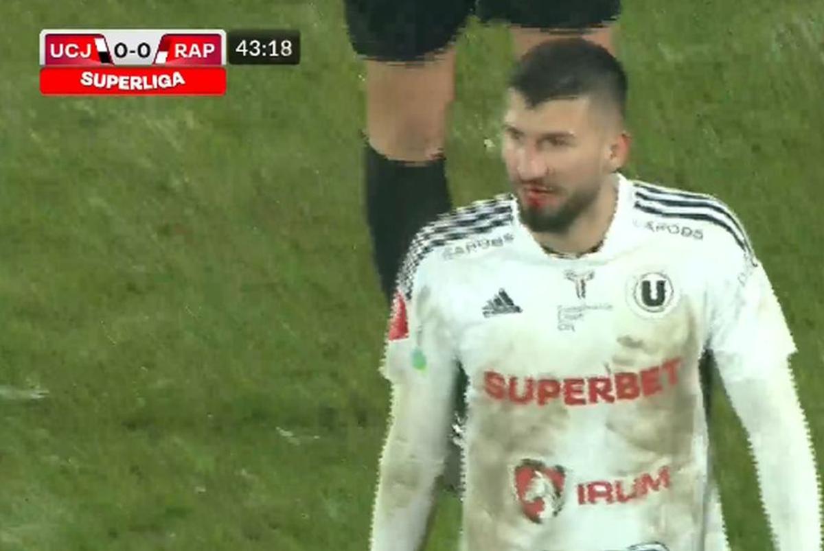 „Accidentat” de arbitru » „Centralul” l-a însângerat pe jucătorul din Superligă