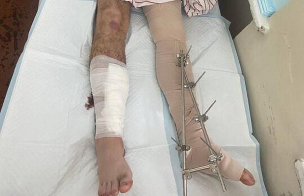 Un multiplu medaliat mondial și european, rănit grav în timpul războiului din Ucraina: „E un adevărat erou”