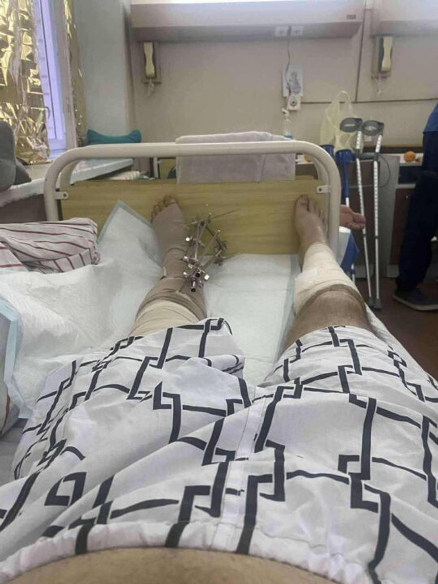 Igor Chervynskiy, rănit grav la picioare în timpul războiului din Ucraina/Foto: usf.org.ua Un multiplu medaliat mondial și european, rănit grav în timpul războiului din Ucraina: „E un adevărat erou”