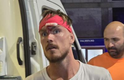 Ambulanța la stadion pentru doi jucători, după Oțelul Galați - Dinamo: unul singur a fost dus la spital