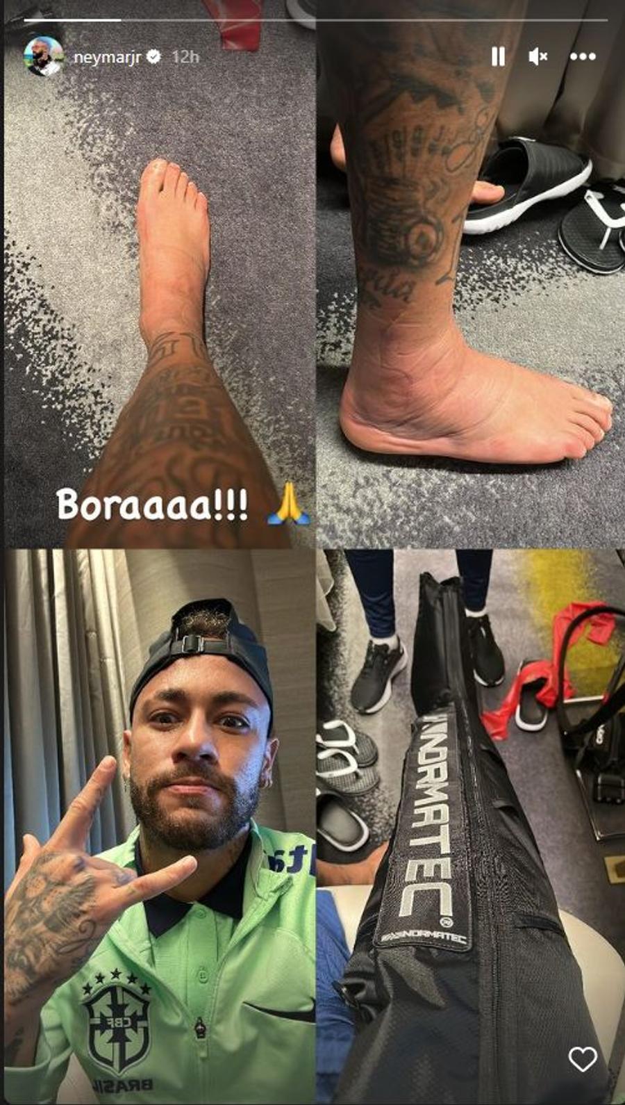 Fotografia postată de Neymar la Insta Story. Foto: Instagram, @NeymarJr Imaginea dură postată de Neymar și mesajul acestuia » Cum arată glezna starului brazilian după duelul „contondent” cu sârbii
