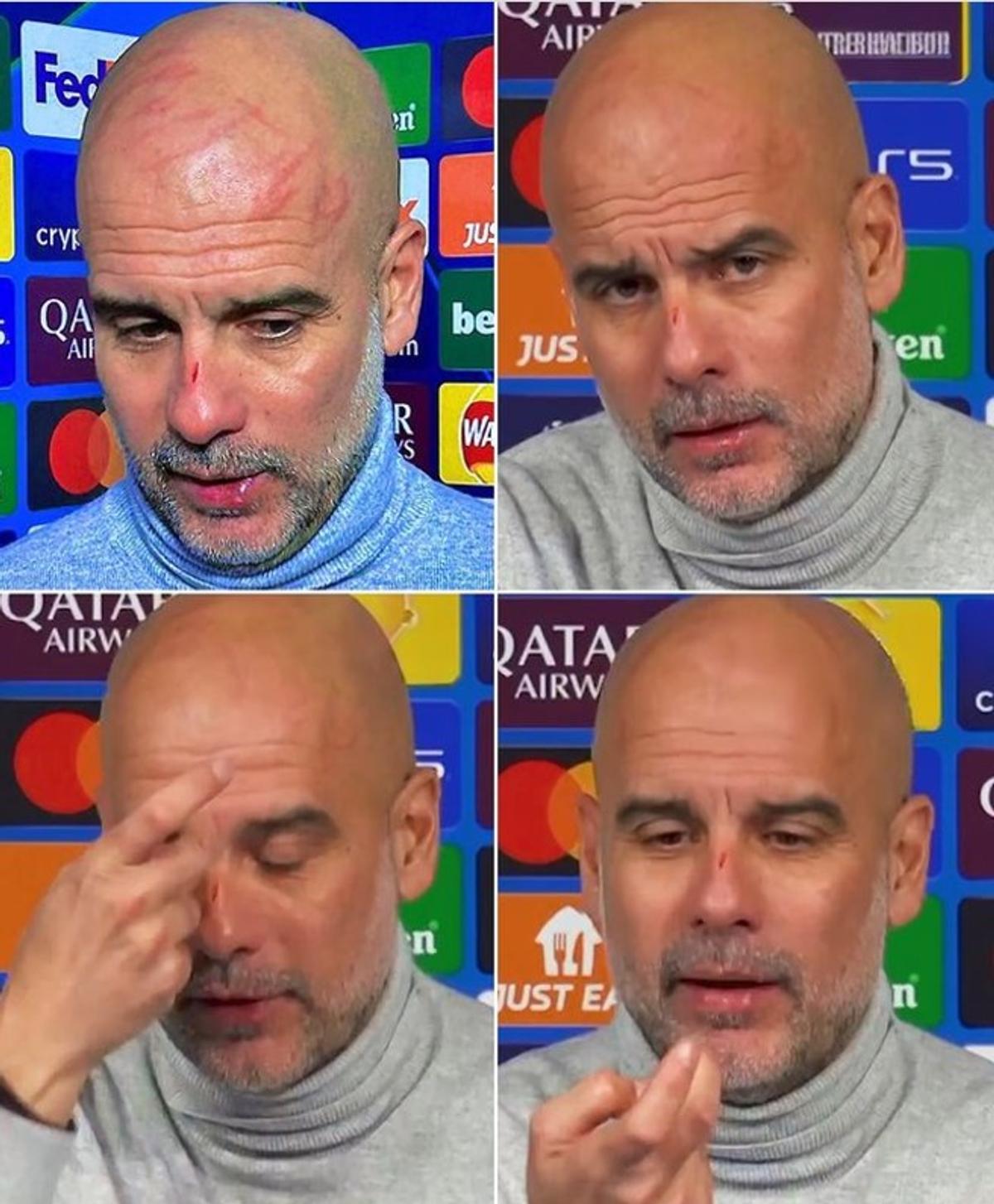 „Vreau să mă rănesc singur” » Pep Guardiola a revenit cu o declarație, la 24 de ore după ce a apărut zgâriat pe cap și pe nas: „Am fost cu garda jos”