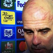 Pep Guardiola, zgâriat pe frunte