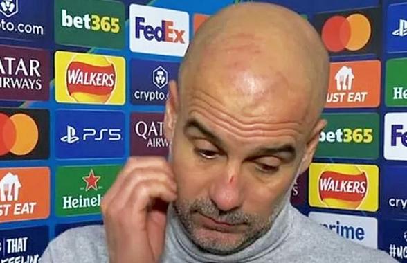„Vreau să mă rănesc singur” » Pep Guardiola a revenit cu o declarație, la 24 de ore după ce a apărut zgâriat pe cap și pe nas: „Am fost cu garda jos”