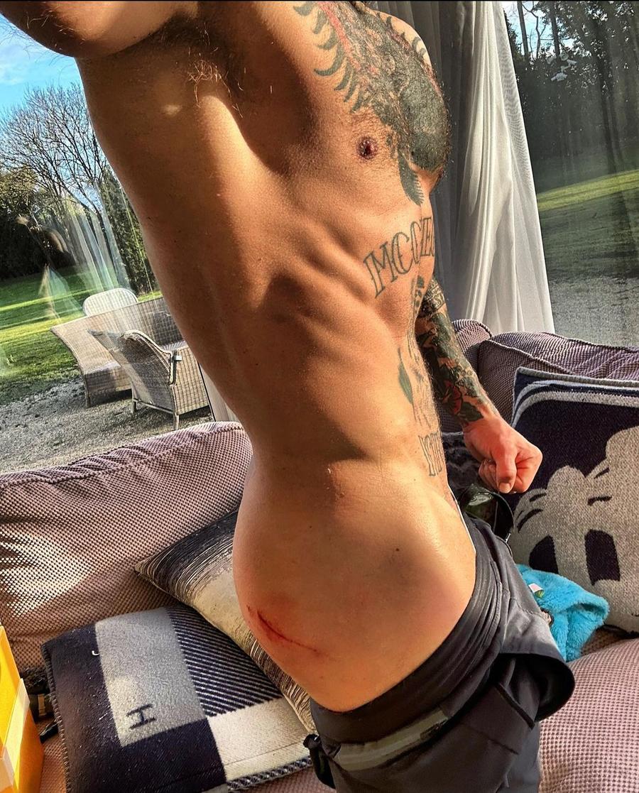 Conor McGregor, lovit de o mașină în timp ce se plimba pe bicicletă! Cum se simte luptătorul UFC