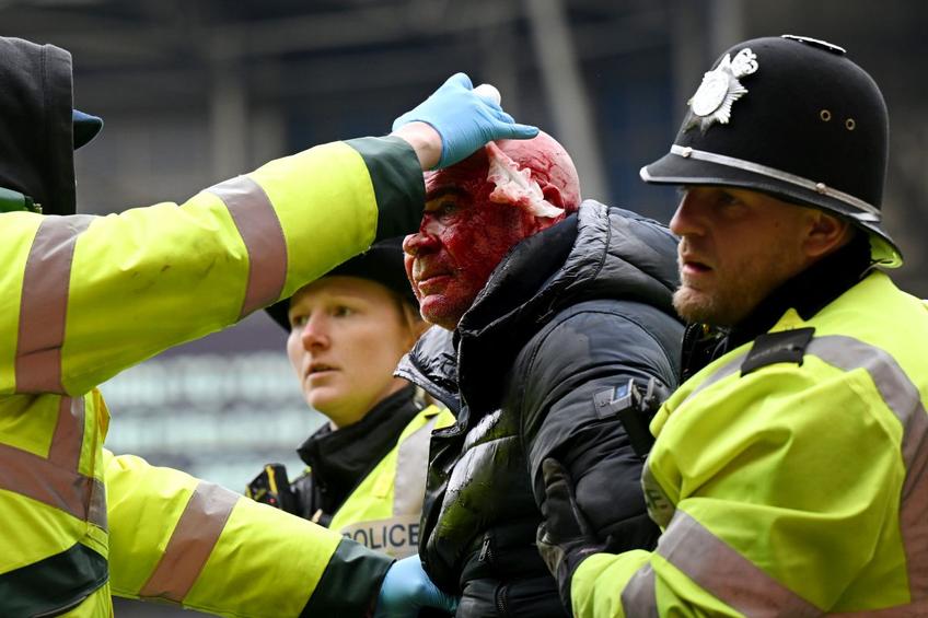 Un fan plin de sânge scos de polițiști de pe teren Foto: Guliver/GettyImages