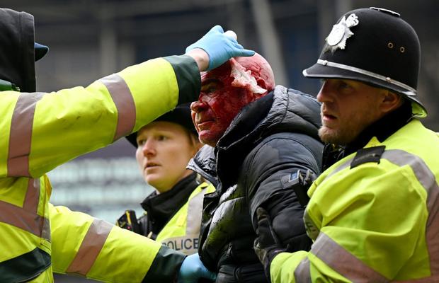 Sânge și fani pe teren! Incidente grave în Cupa Angliei » West Brom - Wolves, suspendat 34 de minute după confruntarea violentă din tribune