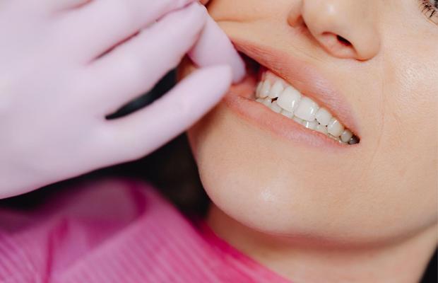 Rezistența și Estetica: Avantajele Zirconiului în Stomatologie