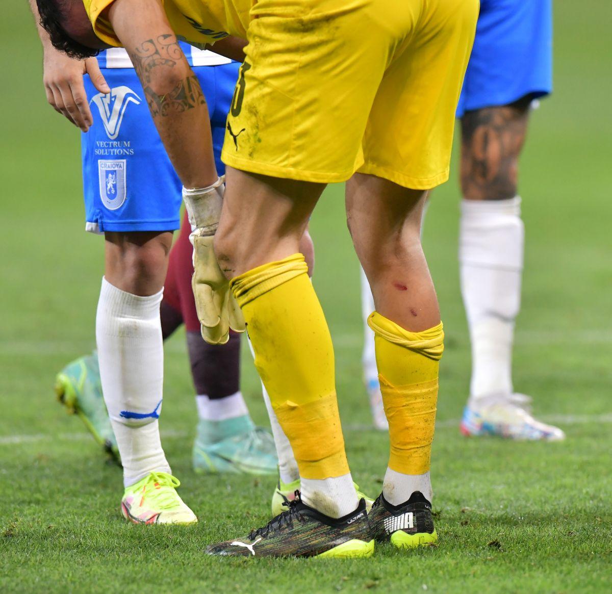 FOTO Rapid - CSU Craiova, meci, 28.08.2021
