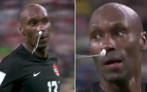 Atiba Hutchinson (39 de ani, mijlocaș defensiv) a folosit un tampon pentru a-și opri hemoragia nazală în timpul partidei Croația - Canada 4-1.