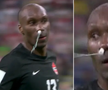 Atiba Hutchinson (39 de ani, mijlocaș defensiv) a folosit un tampon pentru a-și opri hemoragia nazală în timpul partidei Croația - Canada 4-1.