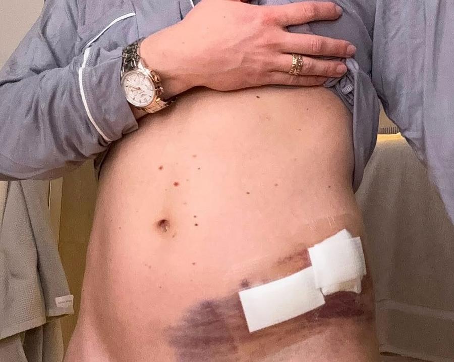 Mikaela Shiffrin revine pe zăpadă la două luni după teribilul accident suferit în Vermont » Chinurile recuperării: „Nu-mi încăpea suficientă mâncare în stomac”