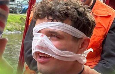 S-a distrat prea tare » Pilotul de Formula 1, cu fața însângerată după o noapte în Amsterdam