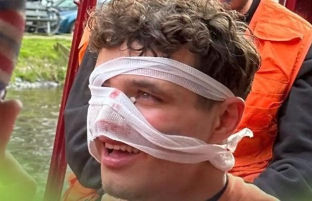 S-a distrat prea tare » Pilotul de Formula 1, cu fața însângerată după o noapte în Amsterdam