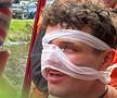 S-a distrat prea tare » Pilotul de Formula 1, cu fața însângerată după o noapte în Amsterdam