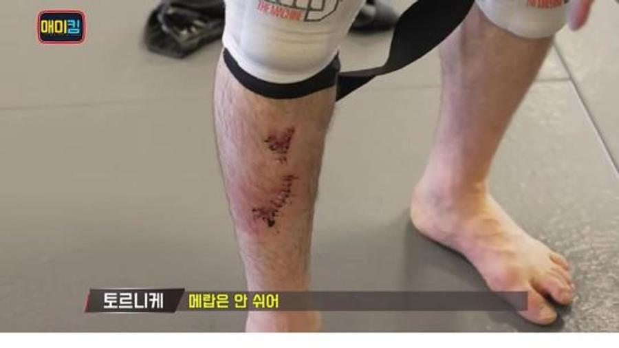 Merab Dvalishvili, infectat cu stafilococ auriu „Pandemia tăcută” din UFC face ravagii » Inclusiv Merab Dvalishvili, campionul categoriei „cocoș”, a avut de suferit! Toți din fenomen sunt expuși