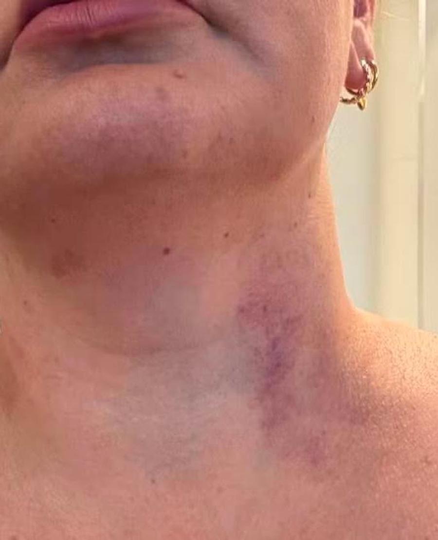 Cazul căpitanului acuzat de viol a luat amploare: „FIFA e în contact permanent cu autoritățile din Noua Zeelandă” » Ryan Mendes riscă să rateze meciul vieții!