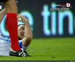 Anzor Mekvabishvili s-a accidentat în Universitatea Craiova - Levski Sofia // FOTO: captură Prima Sport
