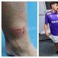 Florin Borța a ajuns la spital după duelul cu Davordzie