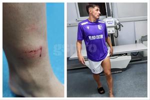 A ajuns direct la spital după faza din FC Argeș - Sepsi! Gazdele acuză că n-a funcționat VAR-ul