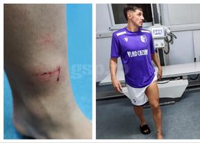 A ajuns direct la spital după faza din FC Argeș - Sepsi! Gazdele acuză că n-a funcționat VAR-ul
