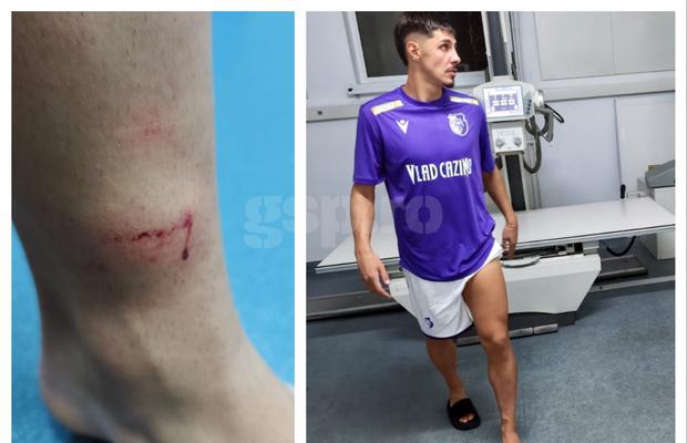 A ajuns direct la spital după faza din FC Argeș - Sepsi! Gazdele acuză că n-a funcționat VAR-ul