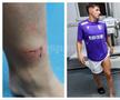 Florin Borța a ajuns la spital după duelul cu Davordzie