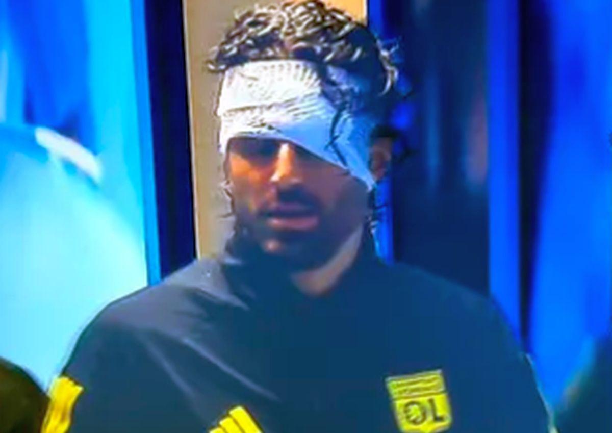 Dezvăluiri despre starea lui Fabio Grosso, rănit de huliganii lui Marseille: „Nu putea susține o conversație, nu părea lucid!”