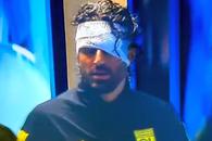 Dezvăluiri despre starea lui Fabio Grosso, rănit de huliganii lui Marseille: „Nu putea susține o conversație, nu părea lucid!”