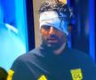 Dezvăluiri despre starea lui Fabio Grosso, rănit de huliganii lui Marseille: „Nu putea susține o conversație, nu părea lucid!”