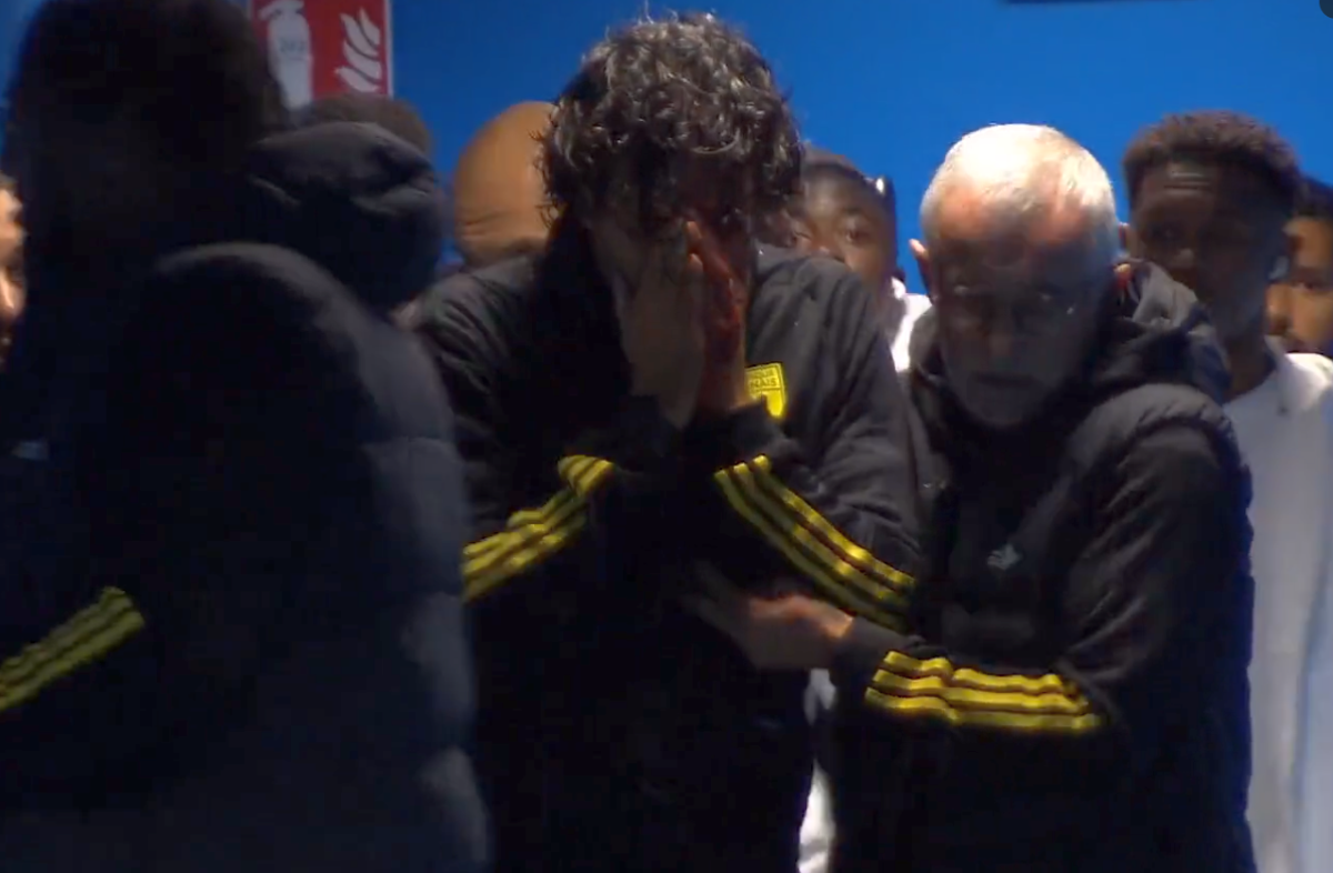 Fabio Grosso, imagini ȘOCANTE din Franța! Antrenorul lui Lyon, plin de sânge după ce autocarul a fost atacat de ultrașii lui Marseille! Meciul poate fi amânat