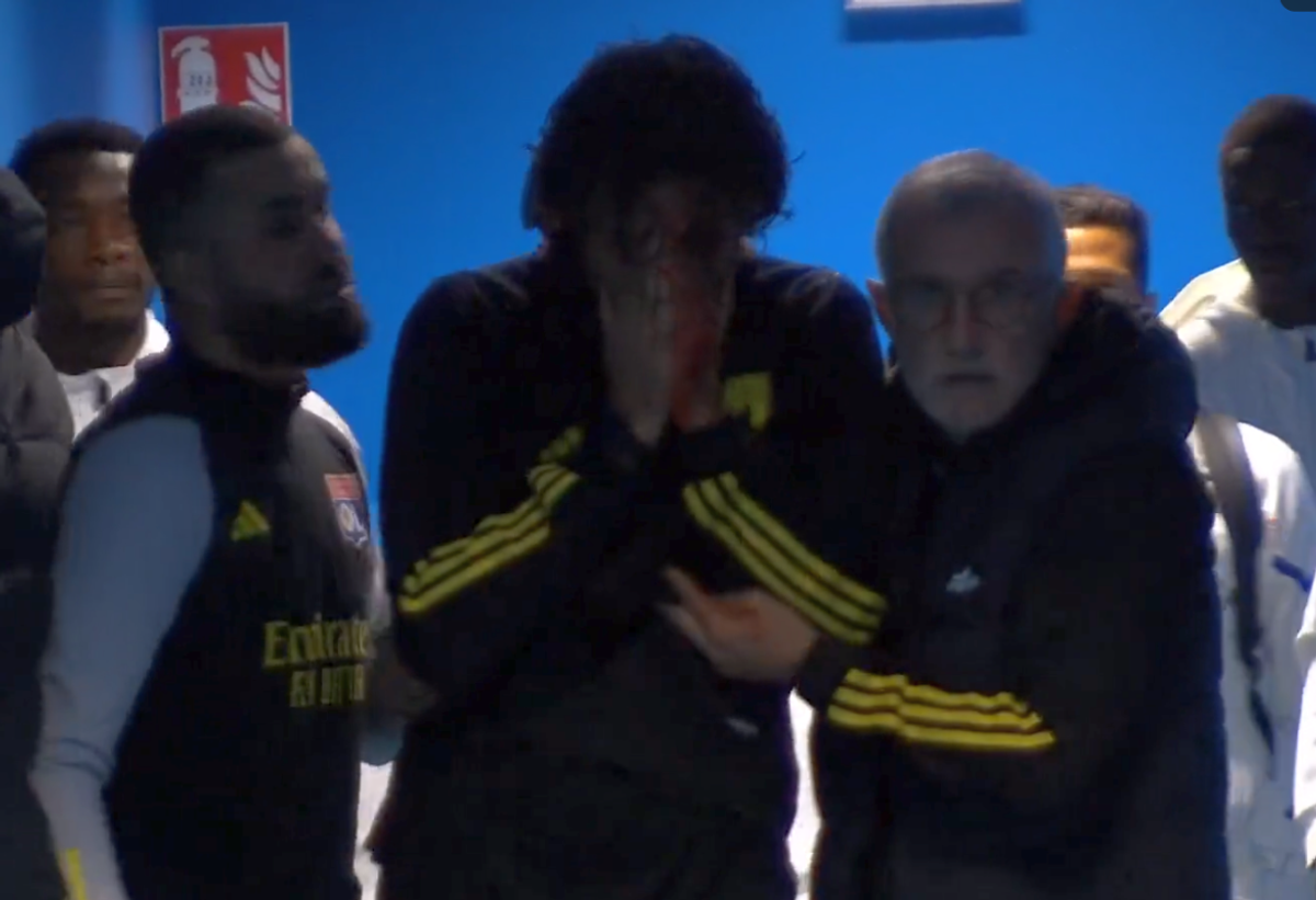 Fabio Grosso, imagini ȘOCANTE din Franța! Antrenorul lui Lyon, plin de sânge după ce autocarul a fost atacat de ultrașii lui Marseille! Meciul poate fi amânat