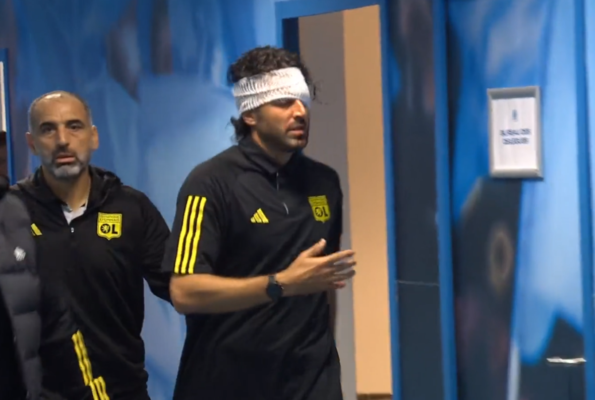 Cum arată fața lui Fabio Grosso, a doua zi după ce a fost atacat cu pietre de ultrașii lui Marseille