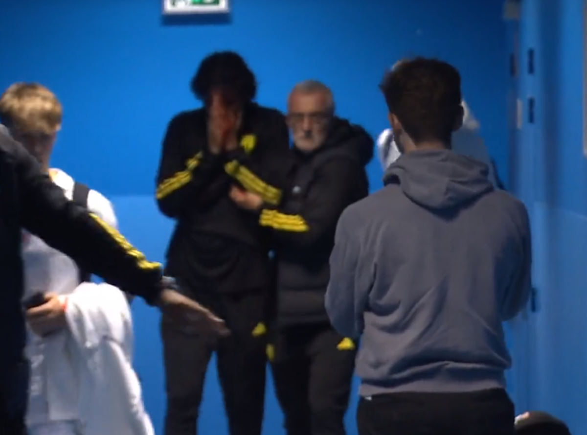 Fabio Grosso, imagini ȘOCANTE din Franța! Antrenorul lui Lyon, plin de sânge după ce autocarul a fost atacat de ultrașii lui Marseille! Meciul poate fi amânat