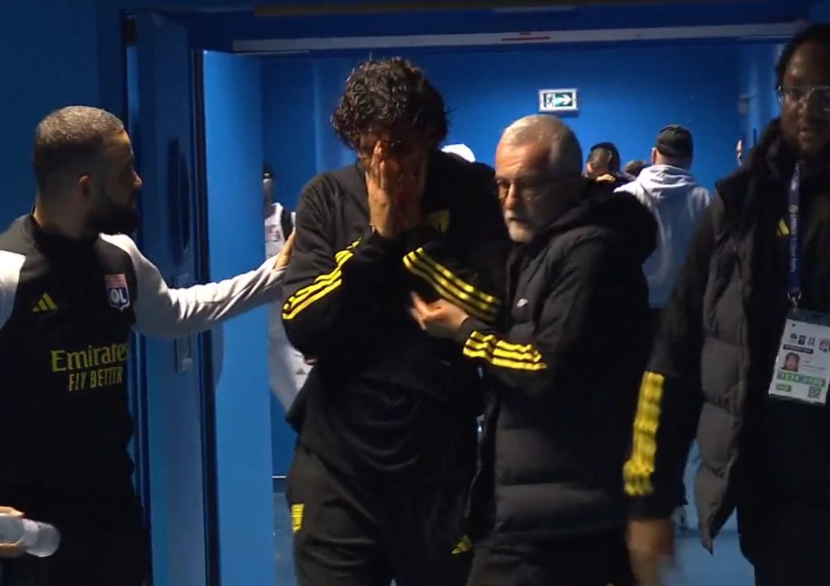 Fabio Grosso, imagini ȘOCANTE din Franța! Antrenorul lui Lyon, plin de sânge după ce autocarul a fost atacat de ultrașii lui Marseille! Meciul poate fi amânat