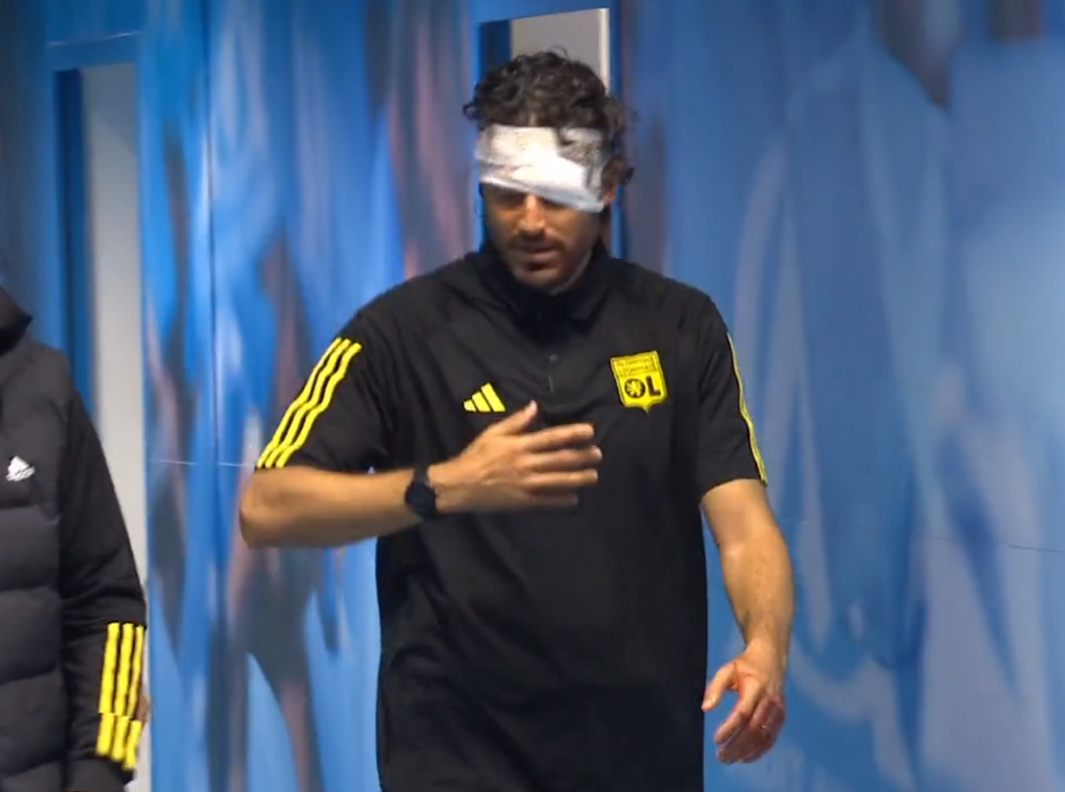 Fabio Grosso, imagini ȘOCANTE din Franța! Antrenorul lui Lyon, plin de sânge după ce autocarul a fost atacat de ultrașii lui Marseille! Meciul poate fi amânat