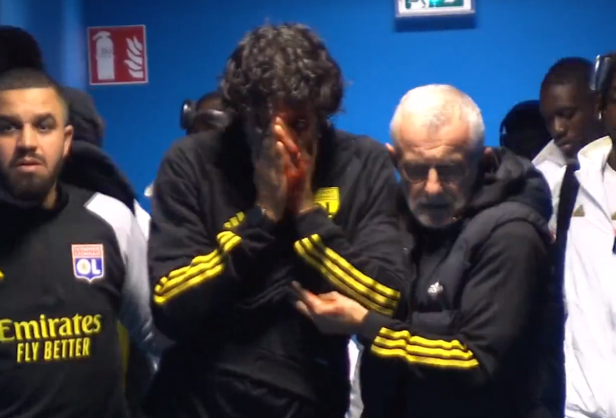 Fabio Grosso, imagini ȘOCANTE din Franța! Antrenorul lui Lyon, plin de sânge după ce autocarul a fost atacat de ultrașii lui Marseille! Meciul poate fi amânat
