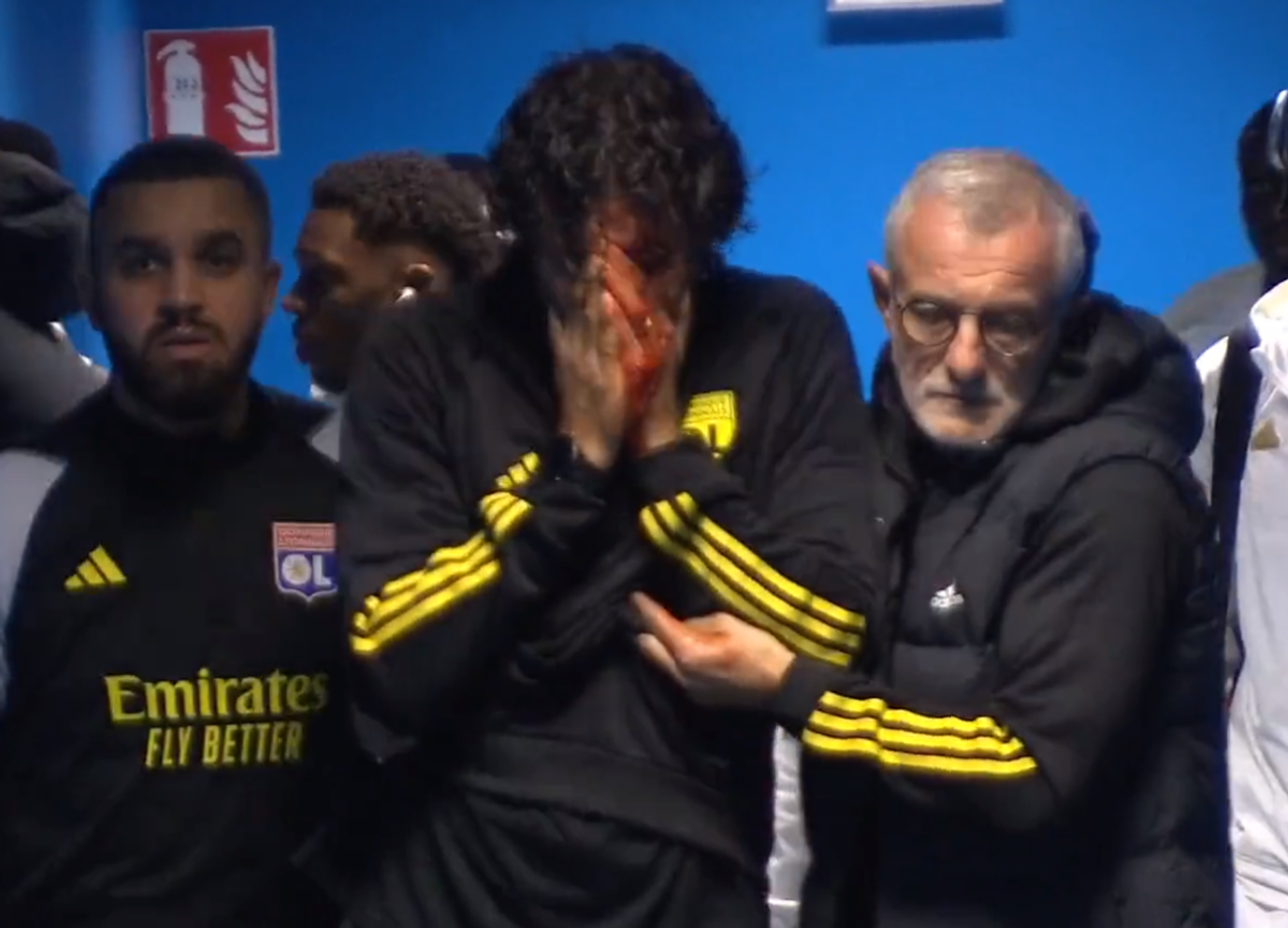 Fabio Grosso, imagini ȘOCANTE din Franța! Antrenorul lui Lyon, plin de sânge după ce autocarul a fost atacat de ultrașii lui Marseille! Meciul poate fi amânat