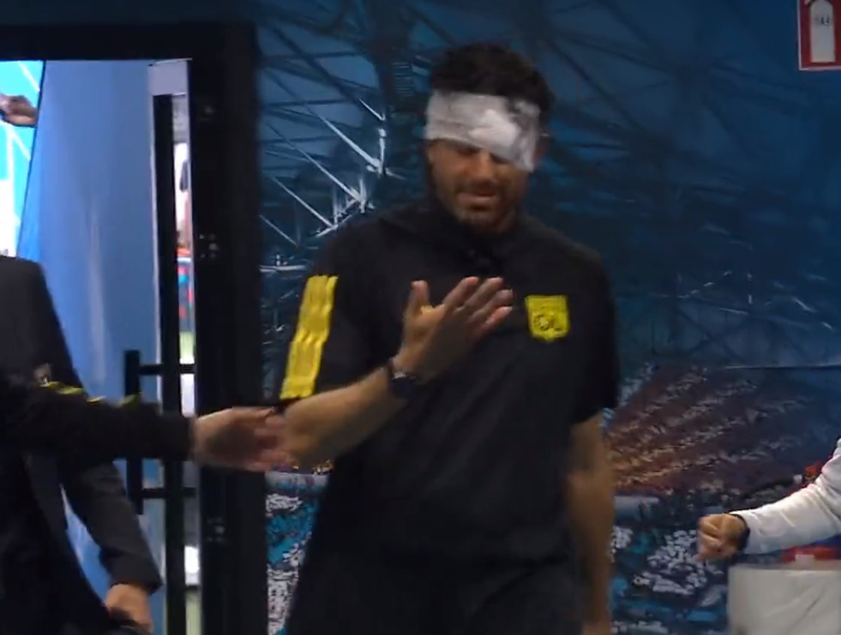 Fabio Grosso, imagini ȘOCANTE din Franța! Antrenorul lui Lyon, plin de sânge după ce autocarul a fost atacat de ultrașii lui Marseille! Meciul poate fi amânat