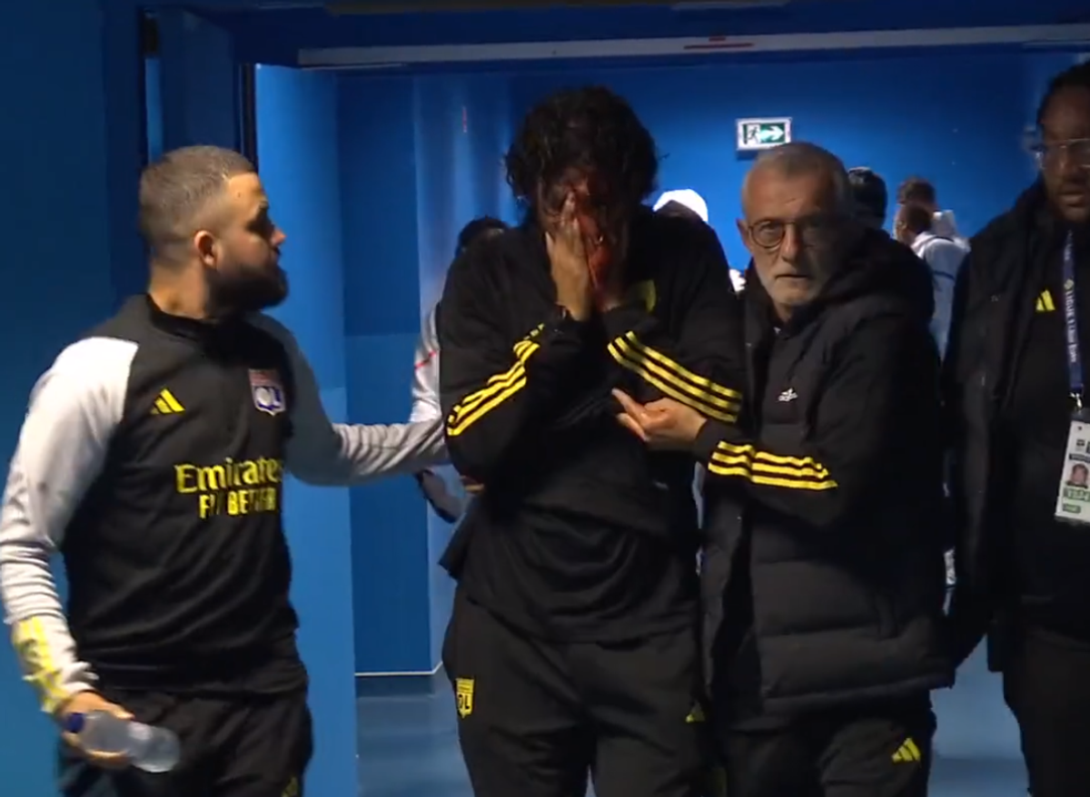 Fabio Grosso, imagini ȘOCANTE din Franța! Antrenorul lui Lyon, plin de sânge după ce autocarul a fost atacat de ultrașii lui Marseille! Meciul poate fi amânat